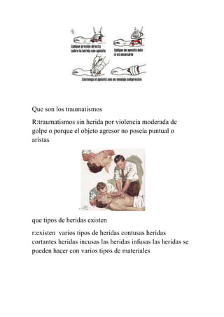 Que son los traumatismos
R:traumatismos sin herida por violencia moderada de
golpe o porque el objeto agresor no poseía puntual o
aristas




                  º


que tipos de heridas existen
r:existen varios tipos de heridas contusas heridas
cortantes heridas incusas las heridas infusas las heridas se
pueden hacer con varios tipos de materiales
 