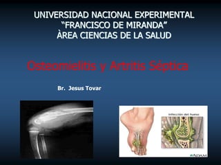 Osteomielitis y Artritis Séptica
Br. Jesus Tovar
UNIVERSIDAD NACIONAL EXPERIMENTAL
“FRANCISCO DE MIRANDA”
ÀREA CIENCIAS DE LA SALUD
 
