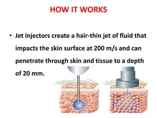 Jet Injecter Jet injector azhar kappil | PPTX