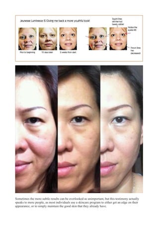 Sometimes the more subtle results can be overlooked as unimportant, but this testimony actually
speaks to more people, as most individuals use a skincare program to either get an edge on their
appearance, or to simply maintain the good skin that they already have.
 