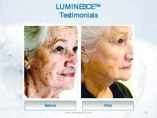 LUMINESCE™
      Testimonials




Before                         After
         www.jeunesse123.com           23
 