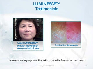 LUMINESCE™
                       Testimonials




       Used LUMINESCE™
       cellular rejuvenation                     Proof with a dermascope
       serum on half of face




Increased collagen production with reduced inflammation and acne

                           www.jeunesse123.com                             24
 