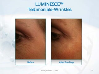 LUMINESCE™
Testimonials–Wrinkles




Before                         After Five Days


         www.jeunesse123.com                     27
 