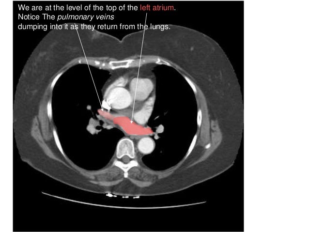 Radiology Thorax