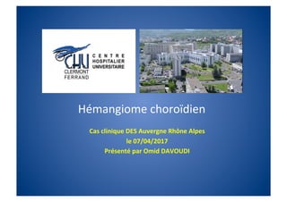 Cas	clinique	DES	Auvergne	Rhône	Alpes		
le	07/04/2017		
Présenté	par	Omid	DAVOUDI	
Hémangiome	choroïdien	
 