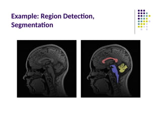 Example: Region Detection,
Segmentation
 