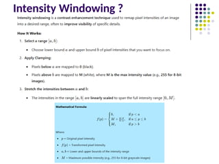 Intensity Windowing ?
 