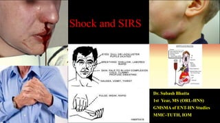 Shock and SIRS
Dr. Subash Bhatta
1st Year, MS (ORL-HNS)
GMSMA of ENT-HN Studies
MMC-TUTH, IOM
 