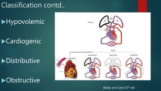 shock_and_sirs in basic otolaryngology.pptx