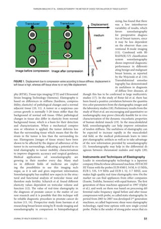 51JOURNAL OF HEALTH SCIENCES 2011; 1 (1)
FAHRUDIN SMAJLOVIC ET AL.: SONOELASTOGRAPHY: THE METHOD OF CHOICE FOR EVALUATION OF TISSUE ELASTICITY
phy (RTSE), Tissue type imaging (TTI) and Ultrasound
Strain Imaging Technology (Siemens). Elastography is
based on differences in stiffness (hardness, compress-
ibility, elasticity) of pathological changes and a normal
adjacent tissue (10, 11). A tumor or a suspicious can-
cerous growth is normally 5-28 times stiffer than the
background of normal soft tissue. Other pathological
changes in tissue also differ in elasticity from normal
background tissue, which is a basis for their detection
and characterization. When a mechanical compres-
sion or vibration is applied, the tumor deforms less
than the surrounding tissue which means that the the
strain in the tumor is less than the surrounding tis-
sue. Elastograms (images of tissue strain) have been
shown to be affected by the degree of adherence of the
tumor to its surroundings, indicating a potential to ex-
tend elastography to tumor mobility characterisation
to improve diagnostic accuracy and surgical guidance.
Medical applications od sonoelastography are
growing in their number every day. Many stud-
ies in different fields of medicine are explor-
ing the possibilities to use this imaging tech-
nique, as it is safe and gives important information.
Sonoelastography has enabled new aspects in the struc-
tural and functional analysis of testicular tissue and
therefore male fertility. Schurich et al. found different
elasticity values dependent on testicular volume and
function (12). The value of real-time elastography in
the diagnosis of prostate cancer is the matter of cur-
rent research and it is possibile that this techique will
be reliable diagnostic procedure in prostate cancer de-
tection (13, 14). Prospective study from Issrman et al.
researching breast lesion sizing by B-mode imaging and
sonoelastography in comparison to histopathological
sizing, has found that there
was a low interobserver
variability of results, which
favors sonoelastography
for preoperative diagnos-
tics of breast tumors, since
it may be less dependent
on the observer than con-
ventional B-mode imaging
(15). Combined with BI-
RADS(R)-US classification
system sonoelastography
shows improved diagnostic
performance in differenti-
ating benign and malignant
breast lesions, as reported
by the Wojcinski et al. (16).
Transabdominal sonoelas-
tography has demonstrated
its usefulness in diagnosis
of diffuse liver diseases, al-
though this has to be confirmed in large multicentric
studies (17). In the study of Botar-Jid et al. there has
been found a positive correlation between the quantita-
tive color parameters from the elastographic images and
the laboratory studies (18). Preliminary results from the
study of Hoyt et al. are encouraging and quantitative so-
noelastography may prove clinically feasible for in vivo
characterization of the dynamic viscoelastic properties
of human skeletal muscle (19). In the musculoskeletal
field, sonoelastography can help improve estimation
of tendon stiffness. The usefulness of elastography can
be expected to increase rapidly in the musculoskel-
etal field, as the medical professionals learn to inter-
pret elastographic artifacts as well as to take advantage
of the new information provided by sonoelastography
(5). Sonoelastography may help in the differential di-
agnosis between rheumatoid nodules and tophi (20).
Instruments and Techniques of Elastography
Leader in sonoelastography technology is a Japanese
company Hitachi whose ultrasound machine, HITACHI
HI Vision with the probes EUB 8500 L 54 M, 6-13 MHz,
EUB L 53S, 5-9 MHz and EUB L 52, 3-7 MHZ, now
makes high-quality real-time elastography view. On the
market we can find appliances from other companies
(Esaote, Toshiba, Siemens) with equal features. The first
generation of these machines appeared in 1997 (Ophir
et al.), and work on them was based on processing dif-
ferential radio frequency signal before and after tissue
compression with probe, so called static elastography. In
period from 2003 to 2007 was developed 2nd
generation
machines, so called Supersonic shear wave elastography
technology, rapid time options with new single crystal
probe. Probe is the sender of strong pulse waves that ex-
FIGURE 1. Displacement due to compression varies according to tissue stiffness. displacement in
soft tissue is high, whereas stiff tissue show no or very little displacement.
 