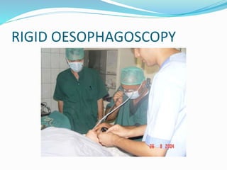 RIGID OESOPHAGOSCOPY
 
