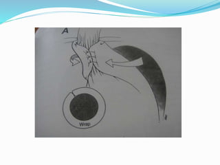 DOC-20230219-WA0087.diseaes_esofags.pdf