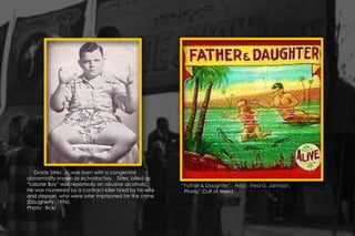 “Father & Daughter”. Artist: Fred G. Johnson.
Photo: Cult of Weird
Grady Stiles, Jr. was born with a congenital
abnormality known as ectrodactyly. Stiles, billed as
“Lobster Boy” was reportedly an abusive alcoholic.
He was murdered by a contract killer hired by his wife
and stepson, who were later imprisoned for the crime
(Dougherty, 1996).
Photo: flickr
 