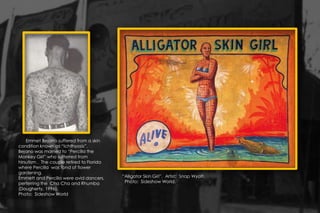 “Alligator Skin Girl”. Artist: Snap Wyatt.
Photo: Sideshow World.
Emmet Bejano suffered from a skin
condition known as “Ichthyosis”.
Bejano was married to “Percilla the
Monkey Girl” who sufferred from
hirsutism . The couple retired to Florida
where Percilla was fond of flower
gardening.
Emmett and Percilla were avid dancers,
perferring the Cha Cha and Rhumba
(Dougherty, 1996).
Photo: Sideshow World
 
