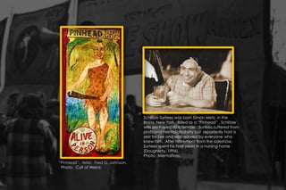 “Pinhead”. Artist: Fred G. Johnson.
Photo: Cult of Weird.
Schlitzie Surtees was born Simon Metz, in the
Bronx, New York. Billed as a “Pinhead” , Schlitzie
was portrayed as a female. Surtees suffered from
profound mental disability but reportedly had a
zest for live and was adored by everyone who
knew him. After retirement from the sideshow,
Surtees spent his final years in a nursing home
(Dougherty, 1996).
Photo: Mentalfloss.
 