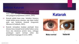 28/09/2023
1
Definisi Katarak
 Katarak adalah kekeruhan yang terjadi pada
lensa mata sehingga menyebabkan penurunan
atau gangguan pengelihatan (Admin, 2009).
 Katarak adalah lensa yang berkabut, biasanya
terjadi akibat proses penuaan, tapi dapat timbul
pada saat kelahiran (katarak kongenital)
(Brunner & Suddarth, 2002).
 Katarak merupakan keadaan patologik lensa
dimana lensa menjadi keruh akibat hidrasi cairan
lensa atau denaturasi protein lensa, sehingga
pandangan seperti tertutup kabut dan
pengelihatan terganggu (Corwin, 2009)
 