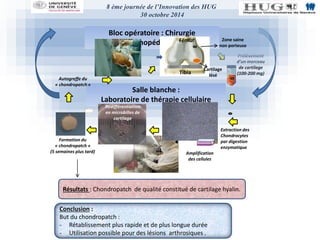 8 ème journée de l’Innovation des HUG 
30 octobre 2014 
Salle blanche : 
Laboratoire de thérapie cellulaire 
Prélèvement 
d’un morceau 
de cartilage 
(100-200 mg) 
Bloc opératoire : Chirurgie 
orthopédique Fémur 
Tibia 
Cartilage 
lésé 
Zone saine 
non porteuse 
Redifférentiation 
en microbilles de 
cartilage 
Formation du 
« chondropatch » 
(5 semaines plus tard) 
Résultats : Chondropatch de qualité constitué de cartilage hyalin. 
Conclusion : 
But du chondropatch : 
- Rétablissement plus rapide et de plus longue durée 
- Utilisation possible pour des lésions arthrosiques . 
Extraction des 
Chondrocytes 
par digestion 
enzymatique 
Amplification 
des cellules 
Autogreffe du 
« chondropatch » 
 