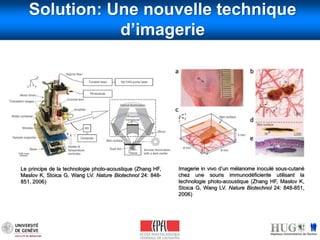 Solution: Une nouvelle technique 
d’imagerie 
Imagerie in vivo d’un mélanome inoculé sous-cutané 
chez une souris immunodéficiente utilisant la 
technologie photo-acoustique (Zhang HF, Maslov K, 
Stoica G, Wang LV. Nature Biotechnol 24: 848-851, 
2006) 
Le principe de la technologie photo-acoustique (Zhang HF, 
Maslov K, Stoica G, Wang LV. Nature Biotechnol 24: 848- 
851, 2006) 
 