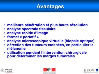 Avantages 
• meilleure pénétration et plus haute résolution 
• analyse spectrale tissulaire 
• analyse rapide d’image 
• format « portatif » 
• analyse microscopique virtuelle (biopsie optique) 
• détection des tumeurs cutanées, en particulier le 
mélanome 
• utilisation pendant l’intervention chirurgicale 
pour déterminer les marges tumorales 
 