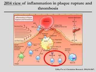 2014 view of inflammation in plaque rupture and 
thrombosis 
Libby P et al. Circulation Research. 2014;114:1867. 
 