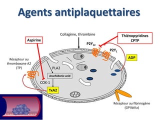 Agents antiplaquettaires 
Collagène, thrombine 
Aspirine CPTP 
PLA2 
Arachidonic acid 
TxA2 
Récepteur au 
thromboxane A2 
(TP) 
P2Y1 
P2Y12 
COX-1 
Thiénopyridines 
ADP 
Récepteur au fibrinogène 
(GPIIbIIIa) 
 