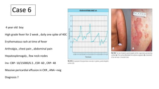 Case 6
4 year old boy
High grade fever for 2 week , daily one spike of 40C
Erythematous rash at time of fever
Arthralgia , chest pain , abdominal pain
Hepatosplenogaly , few neck nodes
Inv- CBP- 10/15000/6.5 , ESR -60 , CRP- 48
Massive pericardial effusion in CXR , ANA –neg
Diagnosis ?
 