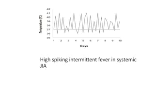 High spiking intermittent fever in systemic
JIA
 