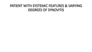 PATIENT WITH SYSTEMIC FEATURES & VARYING
DEGREES OF SYNOVITIS
 