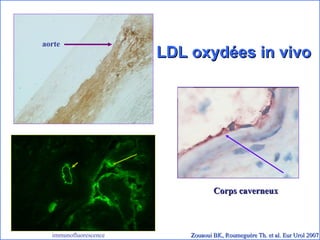 LDL oxydées in vivo Zouaoui BK, Roumeguère Th. et al. Eur Urol 2007 aorte Corps caverneux immunofluorescence 