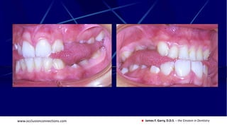 www.occlusionconnections.com James F. Garry, D.D.S. – the Einstein in Dentistry
 