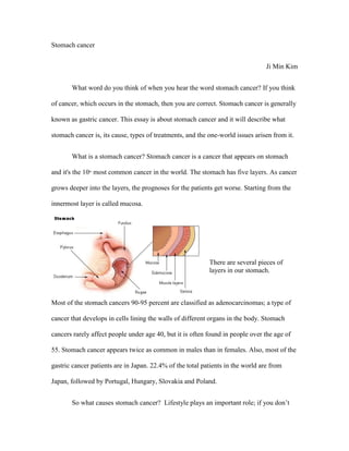 Stomach cancer<br />Ji Min Kim<br />What word do you think of when you hear the word stomach cancer? If you think of cancer, which occurs in the stomach, then you are correct. Stomach cancer is generally known as gastric cancer. This essay is about stomach cancer and it will describe what stomach cancer is, its cause, types of treatments, and the one-world issues arisen from it.<br />There are several pieces of layers in our stomach.What is a stomach cancer? Stomach cancer is a cancer that appears on stomach and it's the 10th most common cancer in the world. The stomach has five layers. As cancer grows deeper into the layers, the prognoses for the patients get worse. Starting from the innermost layer is called mucosa. Most of the stomach cancers 90-95 percent are classified as adenocarcinomas; a type of cancer that develops in cells lined lining the walls of different organs in the body. Stomach cancers rarely affect people under age 40, but it is often found in people over the age of 55. Stomach cancer appears twice as common in males than in females. Also, most of the gastric cancer patients are in Japan. 22.4% of the total patients in the world are from Japan, followed by Portugal, Hungary, Slovakia and Poland. <br />So what causes stomach cancer?  Lifestyle plays an important role; if you don’t live properly, then you might get cancer. Usually, cancer (stomach cancer) happens because of 4 reasons. First, smoking. Tobacco contains carcinogens that does harm to your body. Second, diet. You shouldn't eat food that is too salty or smoked. Salty and smoked food contains nitrates, -a carcinogen-. Third, being morbidly obese. If you are overweighed,t there is a high chance of getting stomach cancer. Finally, it’s family history. There is a good chance of getting stomach cancer if one’s close relatives has or had stomach cancer. Most of the cancers are passed down to son or daughter. Plus, the cancer cells can spread each other. <br />If one gets stomach cancer, they may be nervous and thinking about survival possibility, but there are treatments for stomach cancer. There are three ways of treating the stomach cancer. Surgery, chemotherapy and radiation therapy is the following. All of them work, but I’ll discuss about chemotherapy and radiation therapy. Chemotherapy is basically injecting anticancer drugs into a vein. It is helpful for destroying cancer cells. Nevertheless, it has side effects such as fatigue, nausea, vomiting and hair loss. Radiotherapy is another type of treatment. It uses as high dose radiation and kills cancer cells. The disadvantage of radiation therapy is that it can develop a second cancer and has severe side effects. <br />There are 4 types of symptoms when you get stomach cancer. Feeling nausea, barfing, losing appetite, feeling tired easily and losing weight are the symptoms of stomach cancer. If one corresponds to two or more symptoms above, then there is a possibility of cancer cell growing in one’s body and has to get a proper diagnosis. These are the risk factors of stomach cancer. Blood type A, ages over 50, history of stomach removal are the risk factors and it is likely to occur on people with these conditions. <br />Getting the treatment for stomach cancer can destroy one financially. Cancer treatments can cost a fortune, and some people cannot afford them. According to a dailyfinance.com, many people have pressure to pay the treatment. However, they cannot have a treatment only because of it cost a lot. For example, people who are having terminal stomach cancer need to pay $31,325 in 1996. Which means that it will cost more nowadays. <br />Getting stomach cancer is a social problem too. People can get cancer easily, as I mention earlier, stomach cancer is twice as coon common as in men as women. Old people like over 50, have more possibility of getting stomach cancer. Stomach cancers are related to human’s life style. Such as when you are smocking, eat too salty food or smocked food. Also, when someone get a stomach cancer less than about 40, then there is someone in your family who had a stomach cancer before. Stomach cancer is a hereditary disease. <br />Stomach cancer can be a debacle in one’s life. Stomach cancer has two one-world issues, there are economic and social. It cost a lot of money to remedy the treatments and stomach cancer is related to human’s life. There is a quote about a stomach cancer. “I had no specific bent toward science until my grandfather died of stomach cancer. I decided that nobody should suffer that much” said by Gertrude B.Ellon. It means that it is really pain to have a stomach cancer, don’t make a life hard.<br />Bibliography<br />Unknown, Unknown, What Is Stomach Cancer? , eHealthMD, 12/4/10, http://www.ehealthmd.com/library/stomachcancer/stc_whatis.html<br />Unknown, Unknown, Facts about STOMACH CANCER, Illinois Department of Public Health Home Page, 12/3/10, http://www.idph.state.il.us/cancer/factsheets/stomach.htm<br />Unknown, Unknown, Stomach Cancer- Health Encyclopedia and Reference, HealthCentral.com - Trusted, Reliable and Up To Date Health Information, 12/5/10, http://www.healthcentral.com/encyclopedia/408/301.html<br />Unknown, Unknown, Stomach Cancer- Symptoms of Stomach Cancer, About Cancer, 12/7/10, http://cancer.about.com/od/stomachcancergastric/p/stomachcncrsymp.htm<br />Unknown, Unknown, Stomach Cancer - Stomach Cancer Description - Stomach Cancer Symptoms - Stomach Cancer Prevention - Stomach Cancer Treatment, Symptom Checker - Check Your Symptoms - Check Medical Symptoms, 12/7/10, http://symptomchecker.about.com/od/Diagnoses/stomach-cancer.htm<br />Unknown, Unknown, Radiation Therapy - Radiation Therapy Description - Radiation Therapy Symptoms - Radiation Therapy Prevention - Radiation Therapy Treatment, Symptom Checker - Check Your Symptoms - Check Medical Symptoms, 12/7/10, http://symptomchecker.about.com/od/Diagnoses/radiation-therapy.htm<br />Unknown, Unknown, Stomach cancer - MayoClinic.com, Mayo Clinic medical information and tools for healthy living - MayoClinic.com, 12/6/10, http://www.mayoclinic.com/health/stomach-cancer/DS00301<br />Unknown, Unknown, Care vs. Cost: How Much Is Too Much to Treat Cancer? – DailyFinance, Business News, Stock Quotes, Investment Advice – DailyFinance, 12/7/10, http://www.dailyfinance.com/story/care-vs-cost-how-much-is-too-much-to-treat-cancer/19327597/<br />