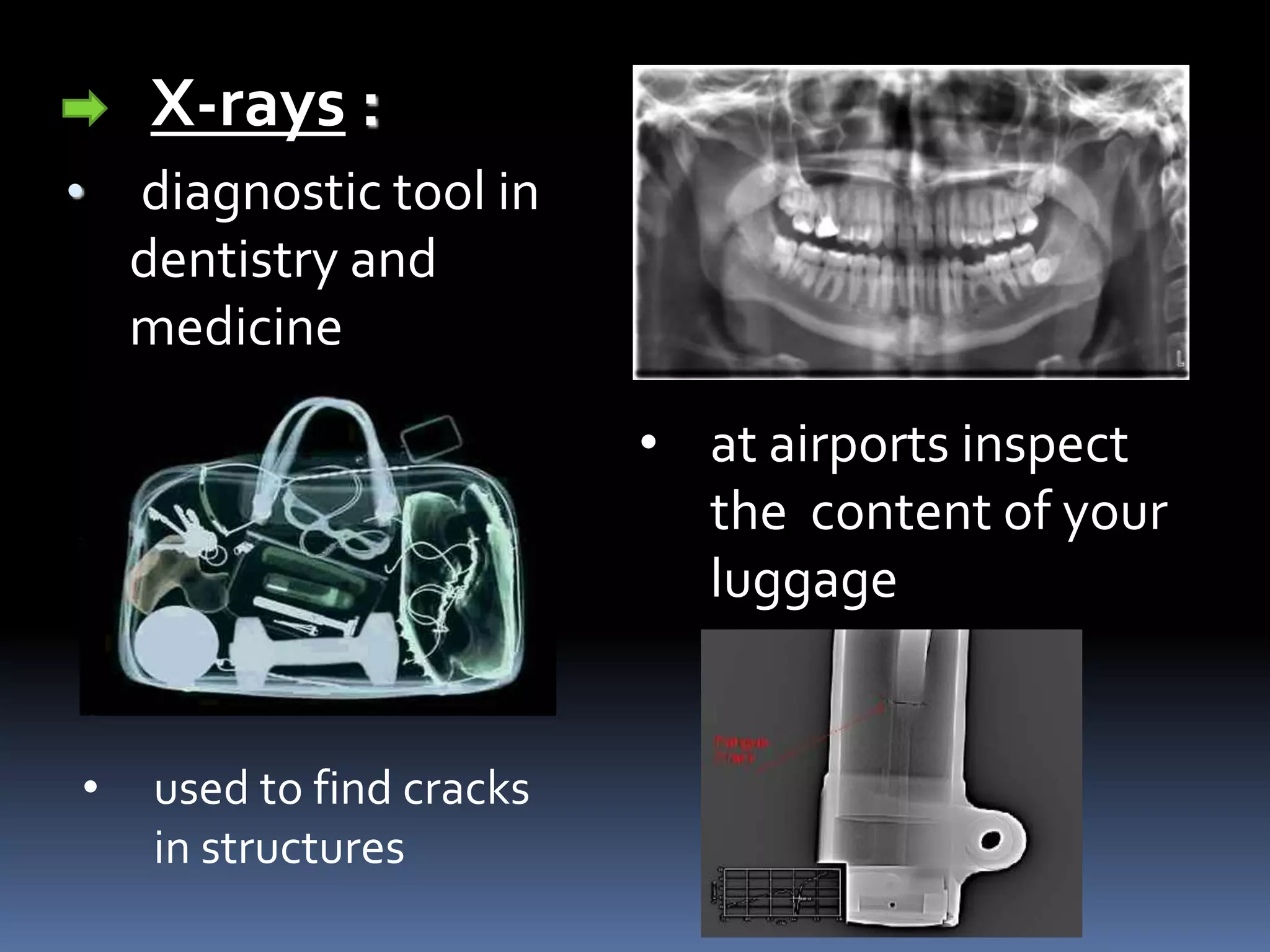 X-rays :
• diagnostic tool in
dentistry and
medicine
• at airports inspect
the content of your
luggage
• used to find cracks
in structures
