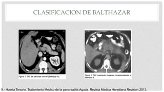 CLASIFICACION DE BALTHAZAR
9.- Huerta Tenorio. Tratamiento Médico de la pancreatitis Aguda. Revista Medica Herediana Revisión 2013.
 