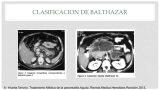 CLASIFICACION DE BALTHAZAR
9.- Huerta Tenorio. Tratamiento Médico de la pancreatitis Aguda. Revista Medica Herediana Revisión 2013.
 