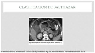 CLASIFICACION DE BALTHAZAR
9.- Huerta Tenorio. Tratamiento Médico de la pancreatitis Aguda. Revista Medica Herediana Revisión 2013.
 