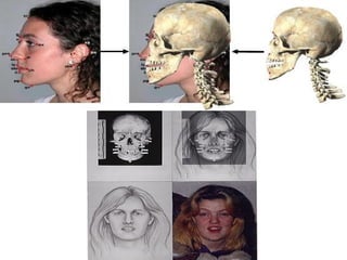 Identification Of Race In Forensic Medicine