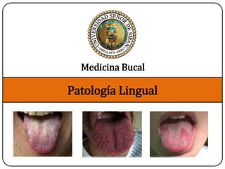 Patología Lingual
Medicina Bucal
 