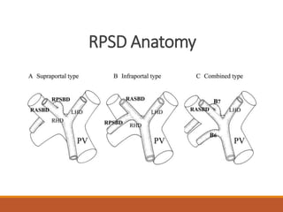 RPSD Anatomy
 