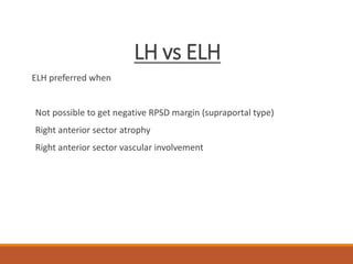 LH vs ELH
ELH preferred when
Not possible to get negative RPSD margin (supraportal type)
Right anterior sector atrophy
Right anterior sector vascular involvement
 