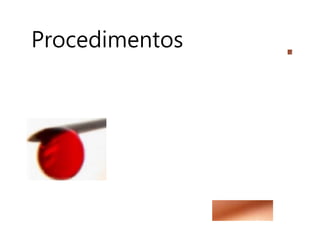 Procedimentos
 