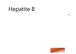 Hepatite B
 