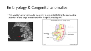 Clockwise Mesenter Rotation Normal Pathology of the large intestines | PPTX