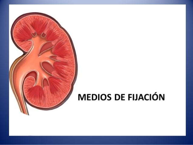 Medio De Fijacion De Los Riñones es.slideshare.net