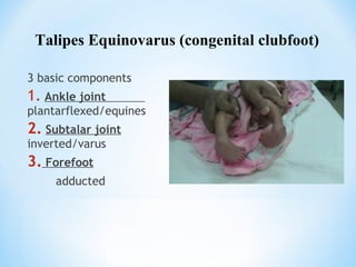 Orthopedic problems in neonates | PPT