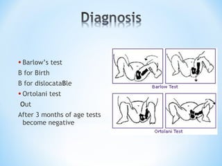 Barwal Test Orthopedic problems in neonates | PPT