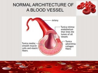 NORMAL ARCHITECTURE OF
A BLOOD VESSEL
 