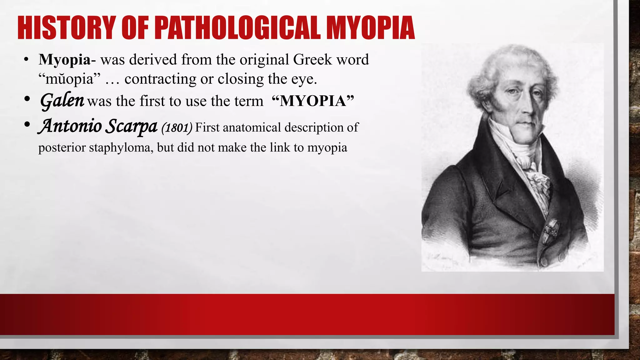 Pathological Myopia | PPTX