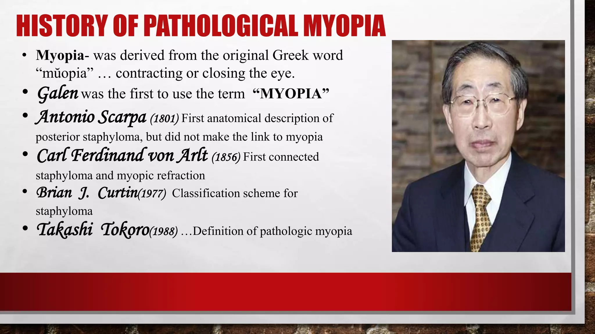 Pathological Myopia | PPTX