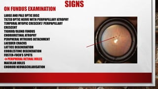 Pathological Myopia | PPTX
