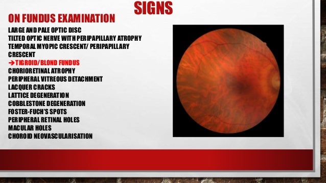 LACQUER CRACKS LATTICE DEGENERATION COBBLESTONE FOSTER FUCHS SPOTS PERIPHERAL RETINAL HOLES MACULAR CHOROID NEOVASCULARISATION 22 LACQUER CRACKS LATTICE DEGENERATION COBBLESTONE FOSTER FUCHS SPOTS PERIPHERAL RETINAL HOLES MACULAR CHOROID NEOVASCULARISATION 22